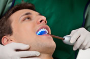 dental bonding albany ny